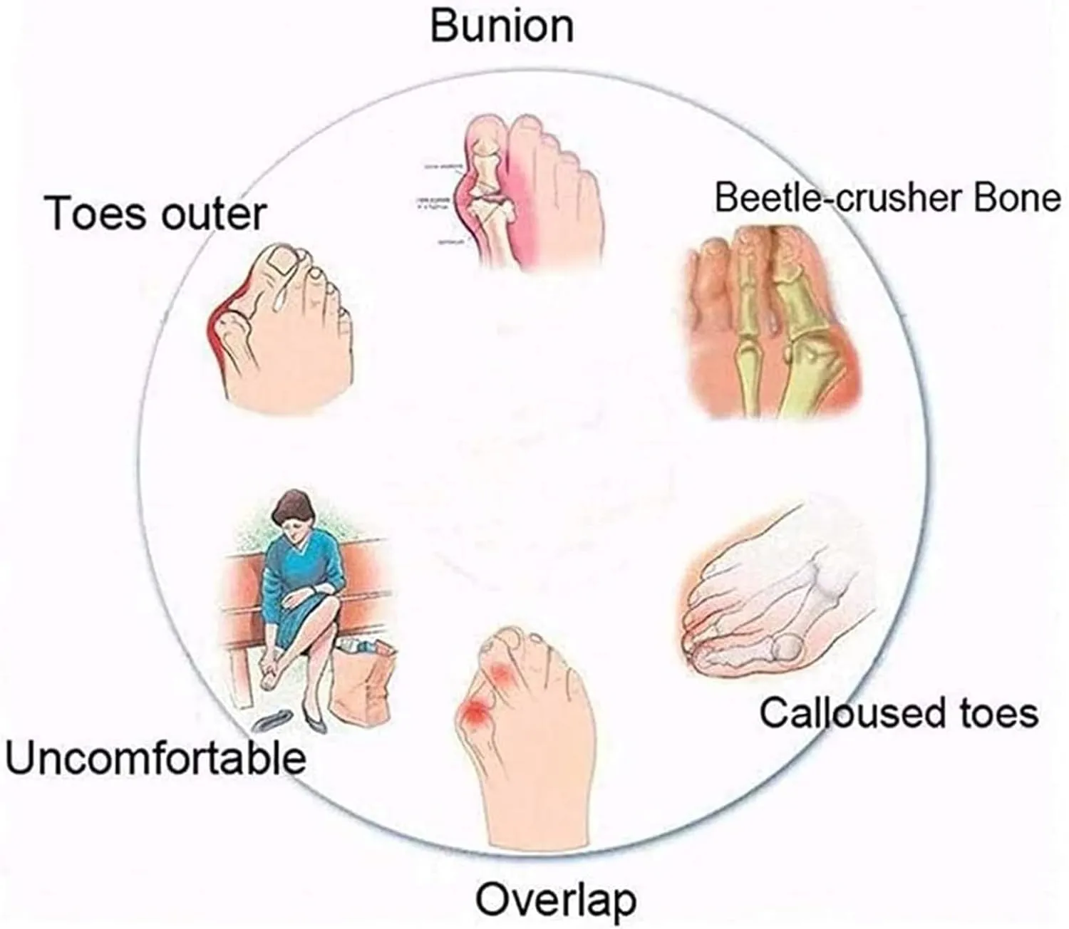 BBPM Women's Orthotics Sandals Bunion Sandals Correction Sandals Comfy Platform Sandals Bunion Correction Sandals Orthopedic Toe Ring Slides Flip Flops,Brown,EU42/US10