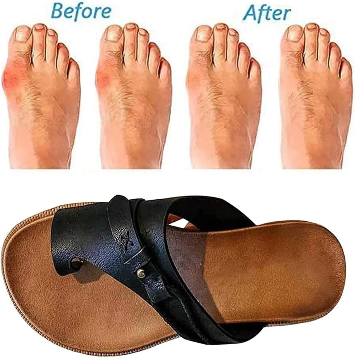 BBPM Women's Orthotics Sandals Bunion Sandals Correction Sandals Comfy Platform Sandals Bunion Correction Sandals Orthopedic Toe Ring Slides Flip Flops,Brown,EU42/US10