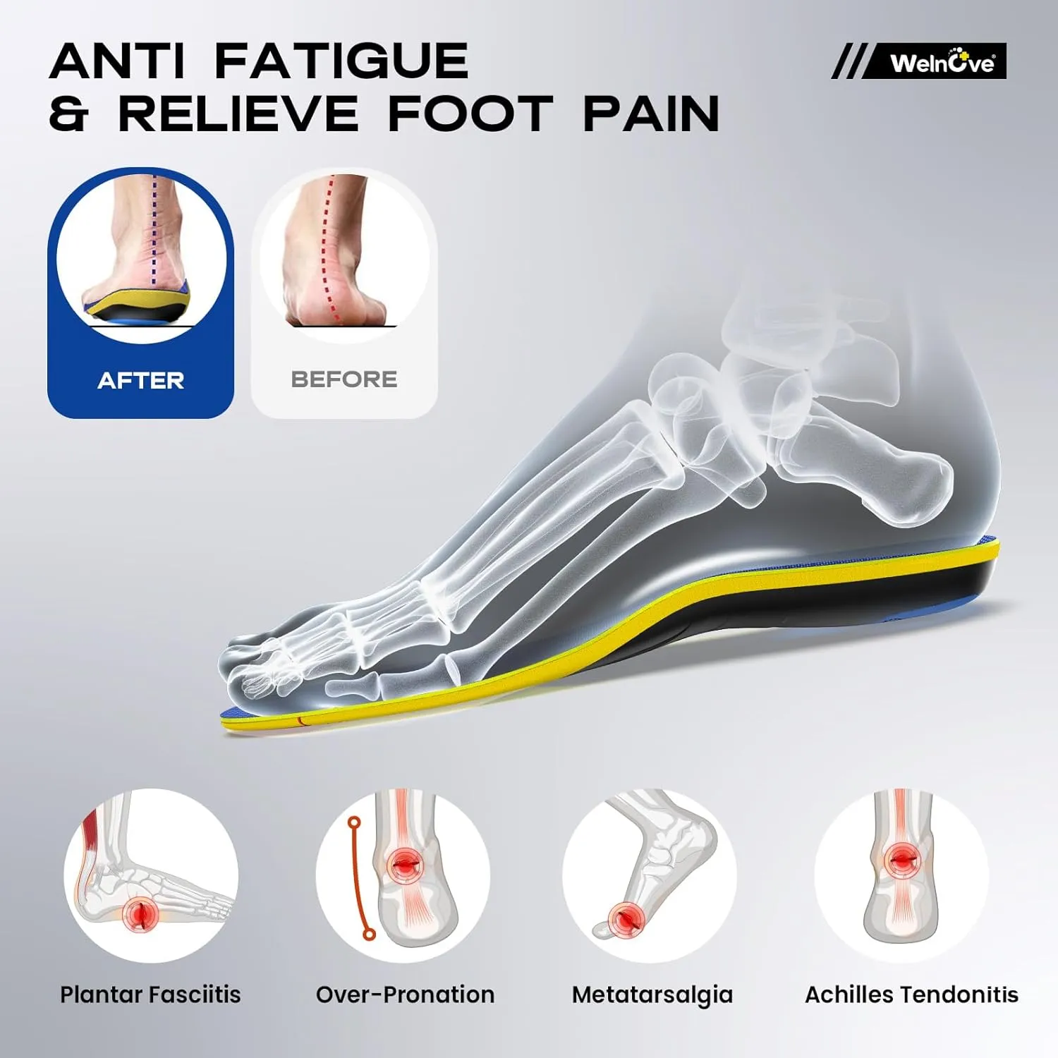 Welnove Plantar Fasciitis Insoles – Sport Arch Support Insoles for Running, Hiking & Standing All Day – Shock Absorption, Heel Pain Relief Heel Spur Insert for Sneakers & Boots(Blue,XL)